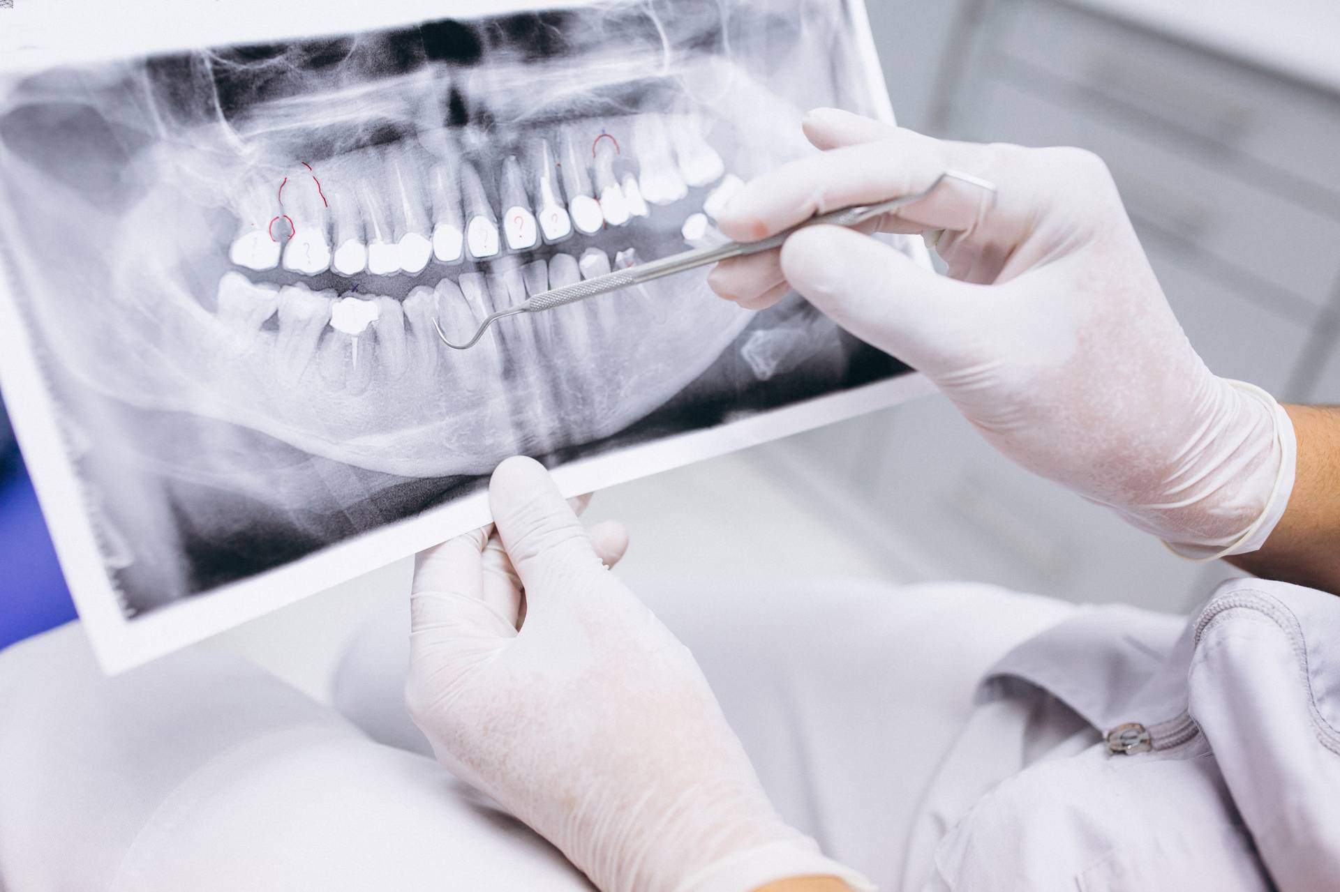 radiologia lastra denti